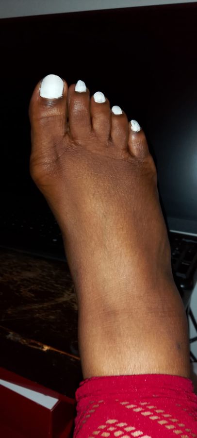 MaryBlidge25