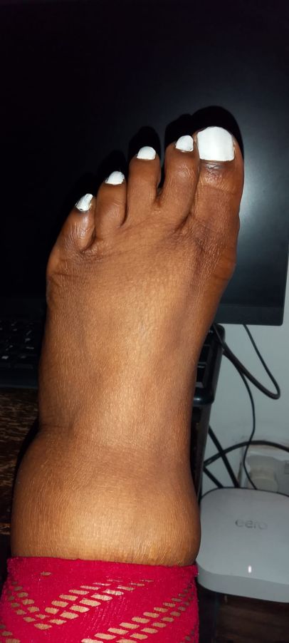 MaryBlidge25