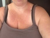 CndyLips