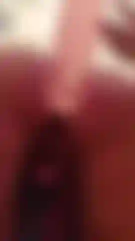 Anal2.