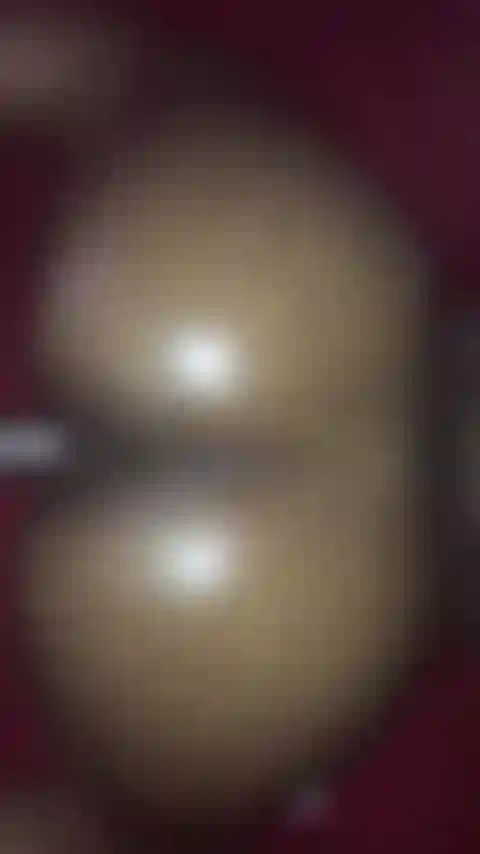 Tiros traseiros oleados.