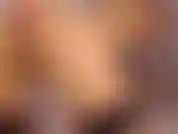 Anal 1(peido,prolapso,gape).