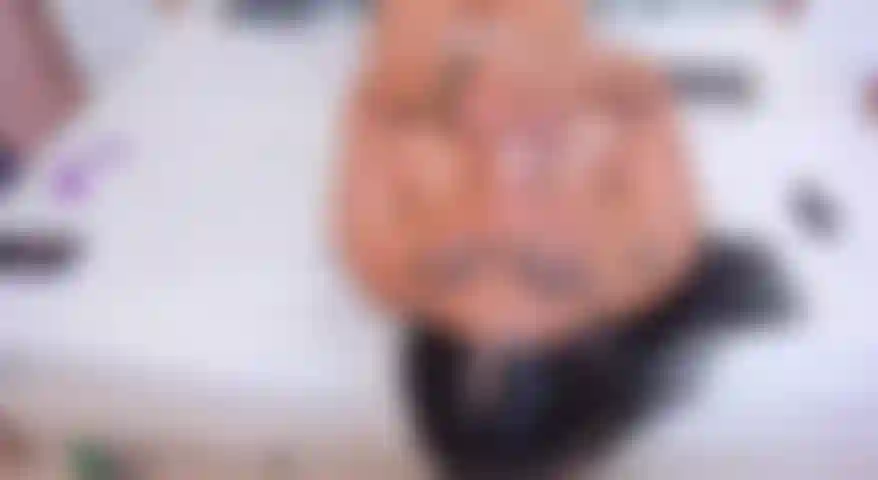 Boquete, saliva reversa.