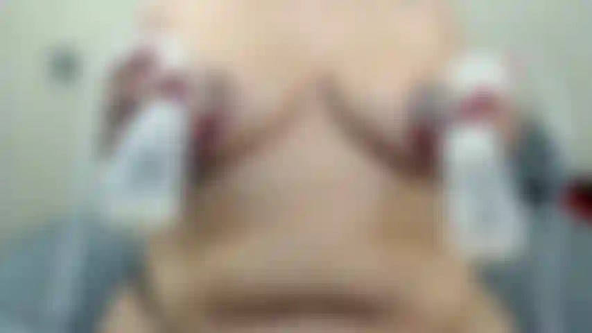 Sessão de extração de leite materno.