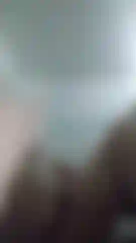 Dupla amputada brincando com cotos.